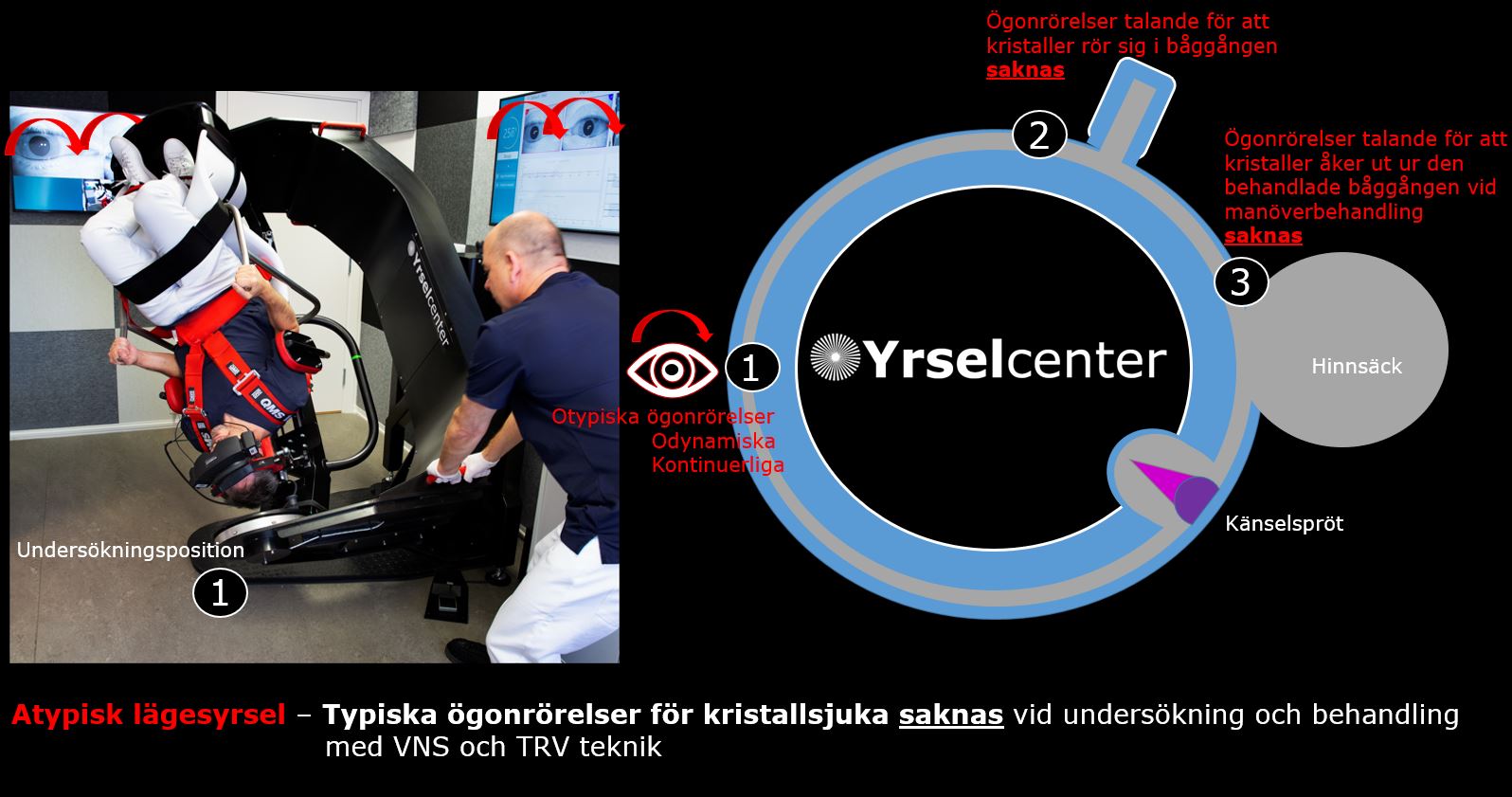 Tecken på atypisk lägesyrsel