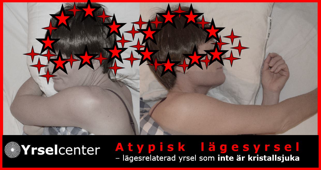 Lägesrelaterad yrsel som inte är kristallsjuka Yrselcenter 2024