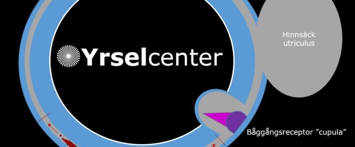 Kronisk kristallsjuka