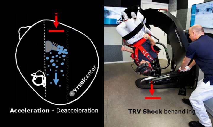TRV teknik mot kristallsjuka